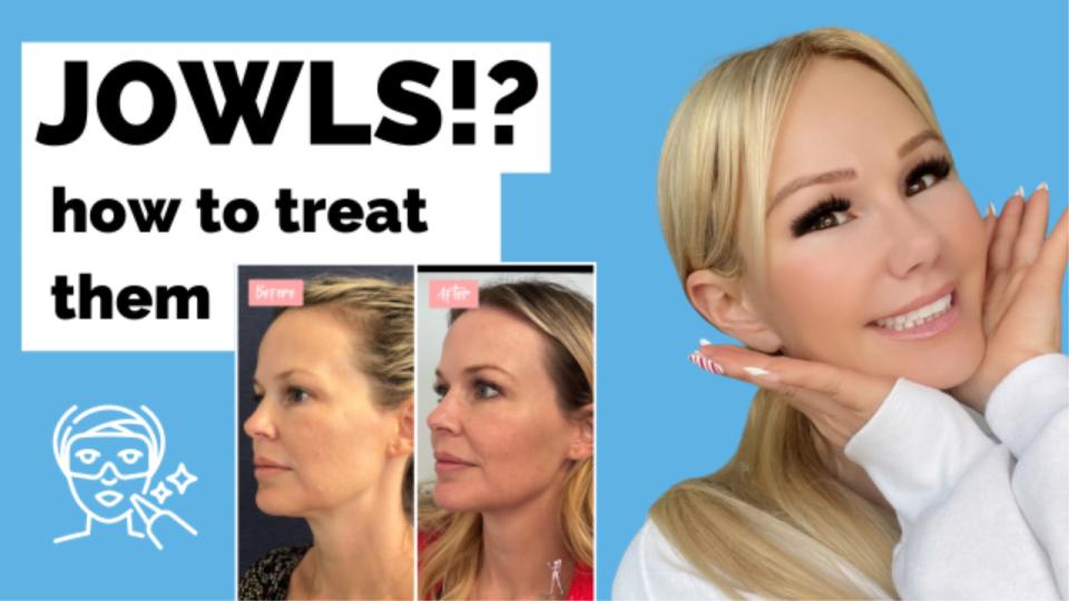 How to treat JOWLS!